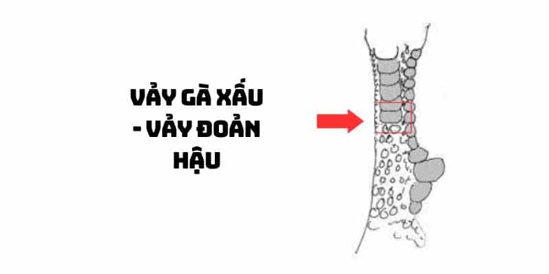 vảy gà xấu